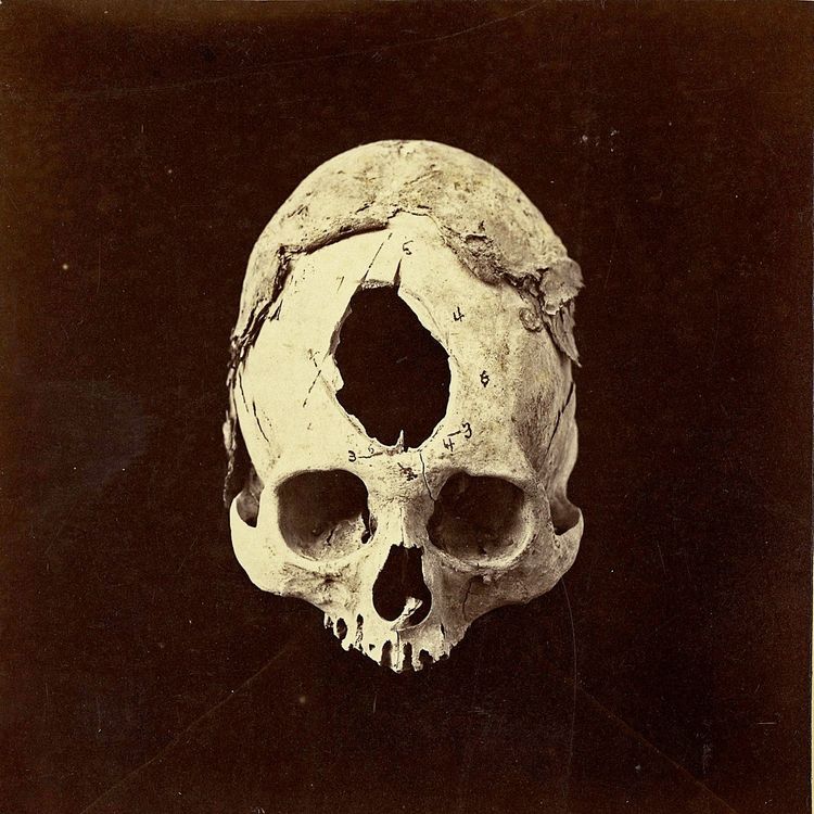 Hey Exit – Nothing is What You Deserve